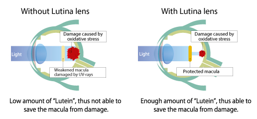 Lutina Tokai lenses HEV protection