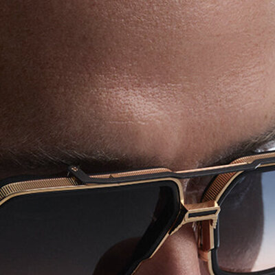 Glasses Frame Allergy — Nickel, Materials & What to Choose