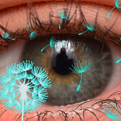 Eye Allergies and Itchy Eyes: Causes and How to Get Relief
