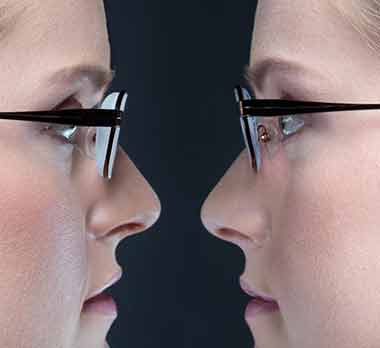 Thickness difference between regular and high-index lenses